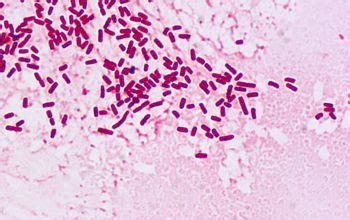 enterobacter aerogenes on emb|Enterobacter spp.: Update on Taxonomy, Clinical .